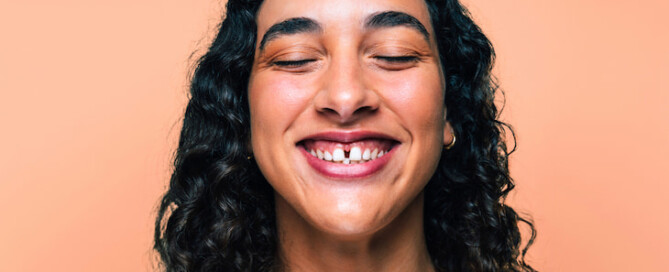 adult woman with diastema