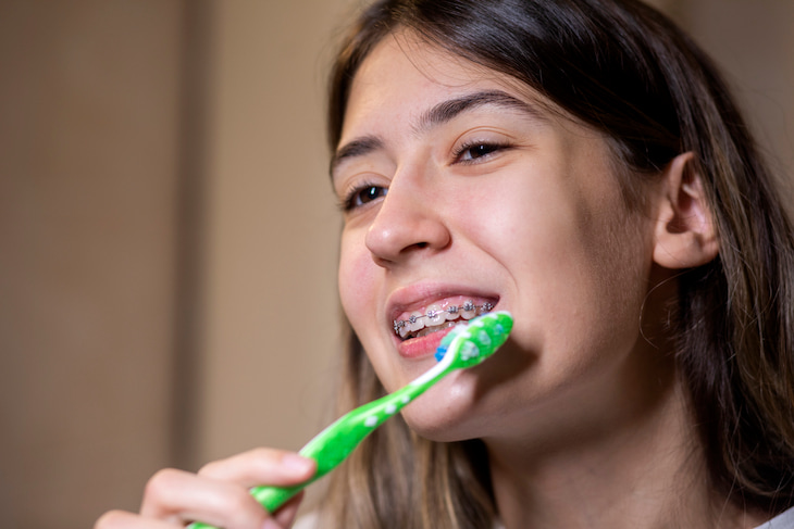 a girl with braces holding a toothbrush