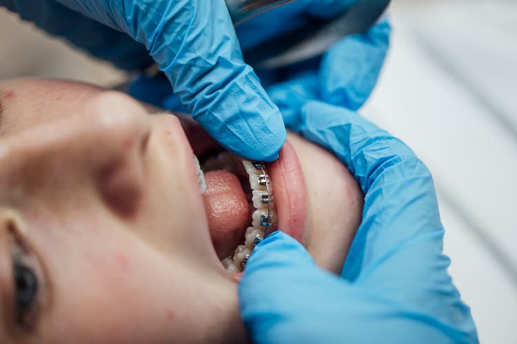 teenager having his braces inspected